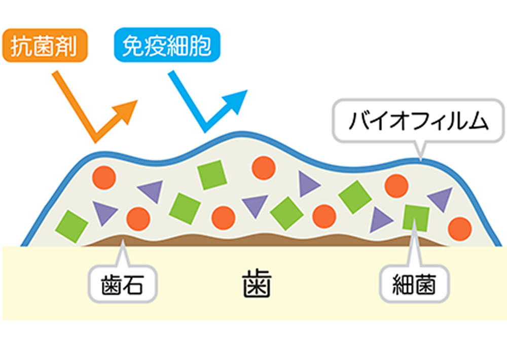 新潟（新潟市中央区本馬越）の歯医者、齋藤歯科医院で予防歯科