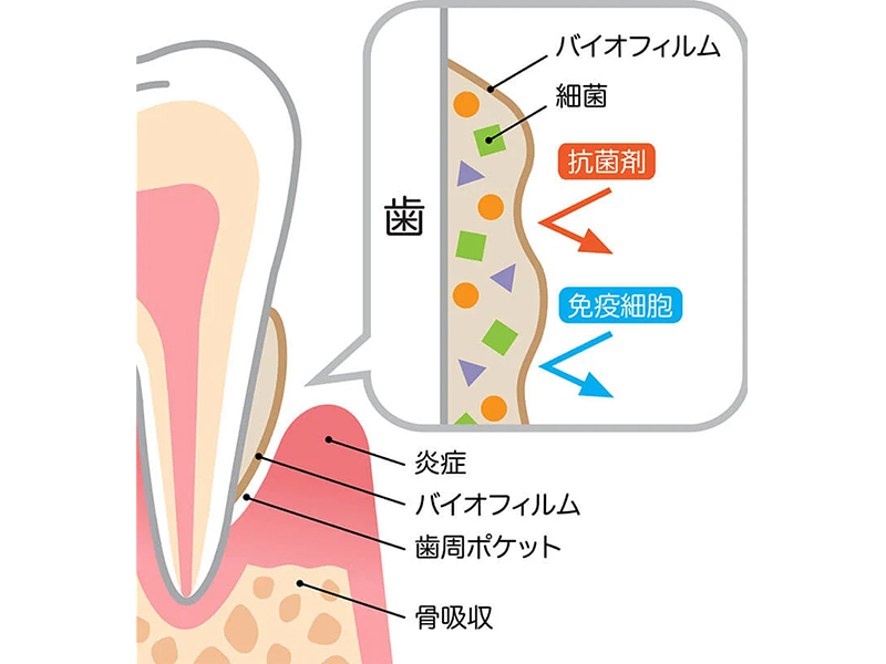 新潟（新潟市中央区本馬越）の歯医者、齋藤歯科医院で予防歯科