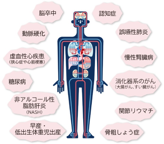 新潟（新潟市中央区本馬越）の歯医者、齋藤歯科医院で歯周病治療