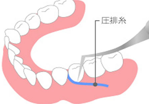 新潟（新潟市中央区本馬越）の歯医者、齋藤歯科医院の審美歯科